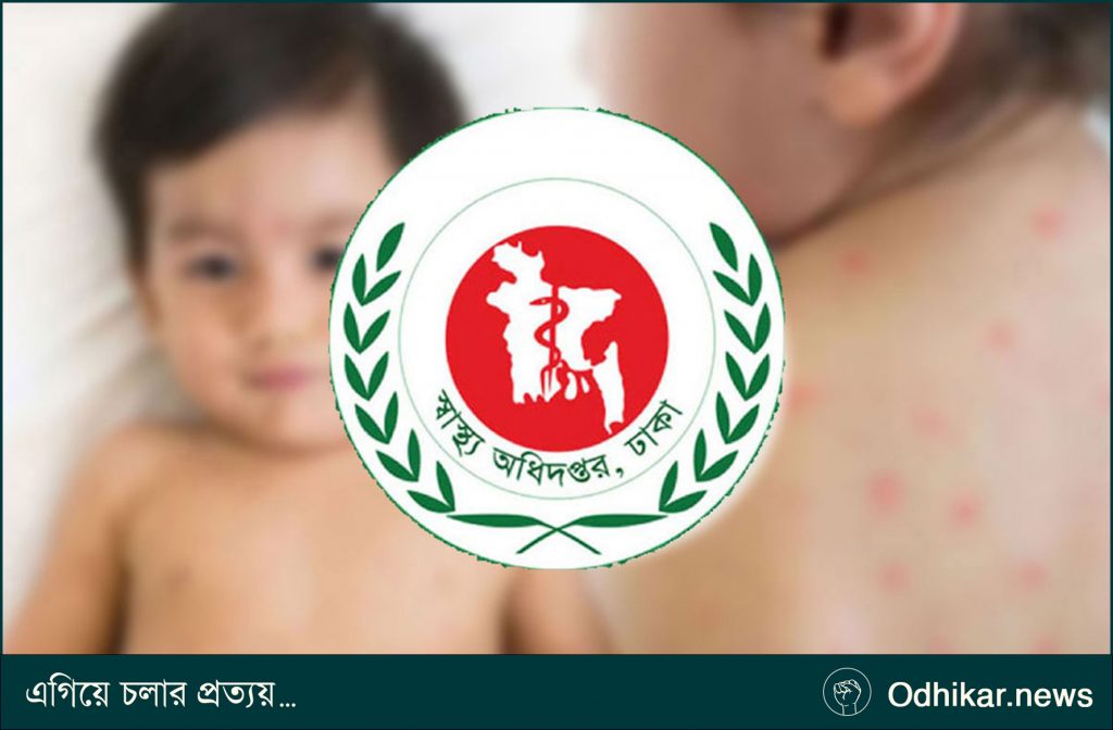 হামের উপসর্গে আরও ৪ শিশুর মৃত্যু