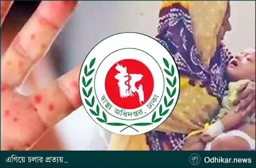হাম সন্দেহে শিশুমৃত্যু ৭০০ ছাড়াল